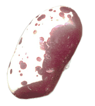 Bohnen